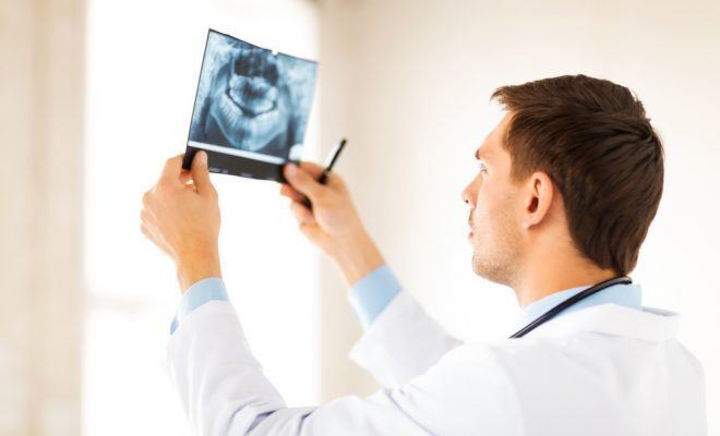 doctor looking at a teeth x ray
